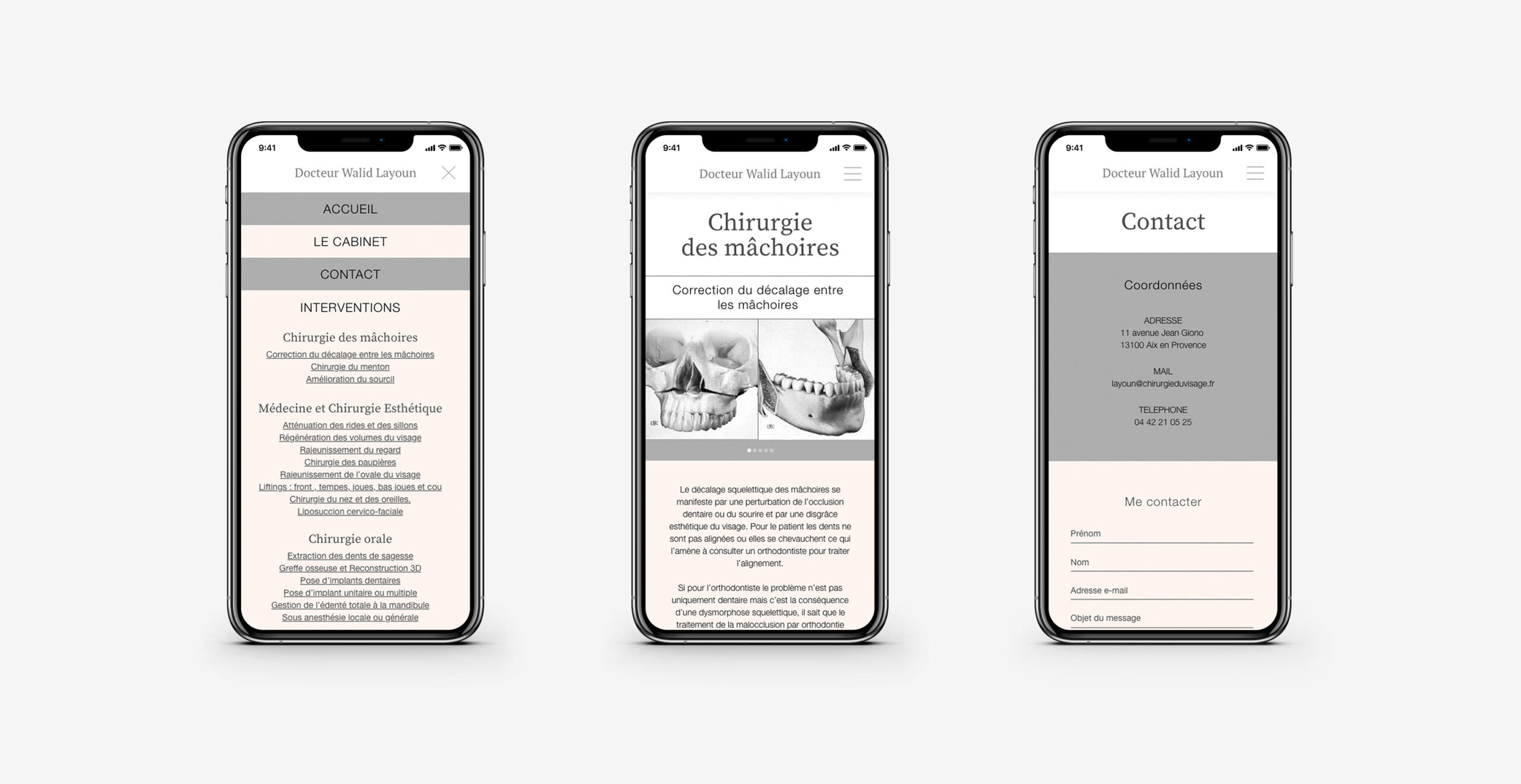 Trois téléphone présentant chacun une partie du site différente en version mobile. Ils présentent le menu, la page chirurgie des mâchoires et la page contact